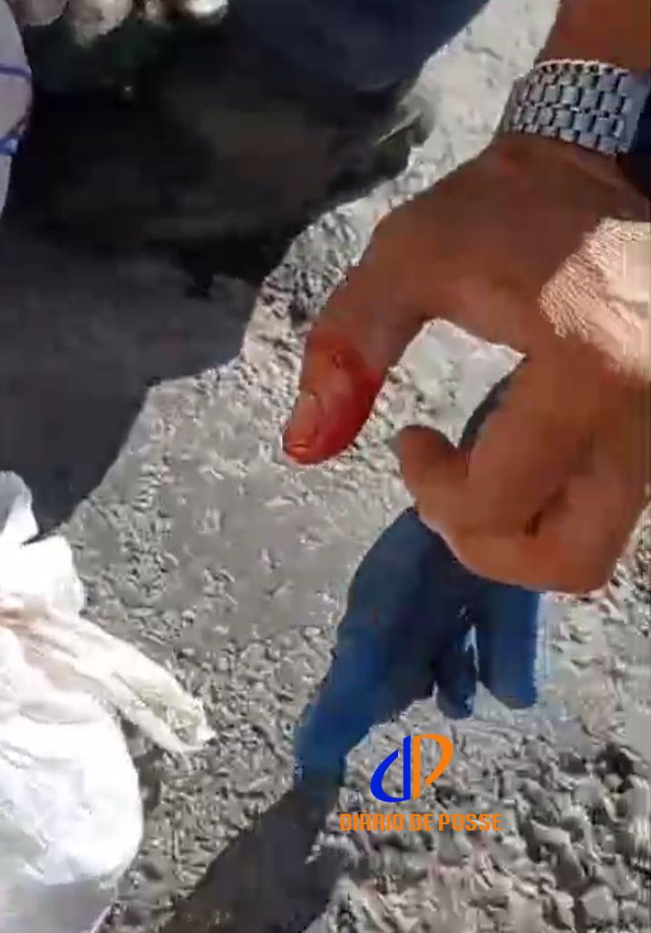 Gari se fere ao recolher lixo com vidro em Posse